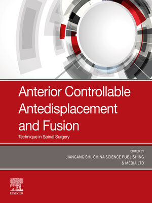 cover image of Anterior Controllable Antedisplacement and Fusion (ACAF)